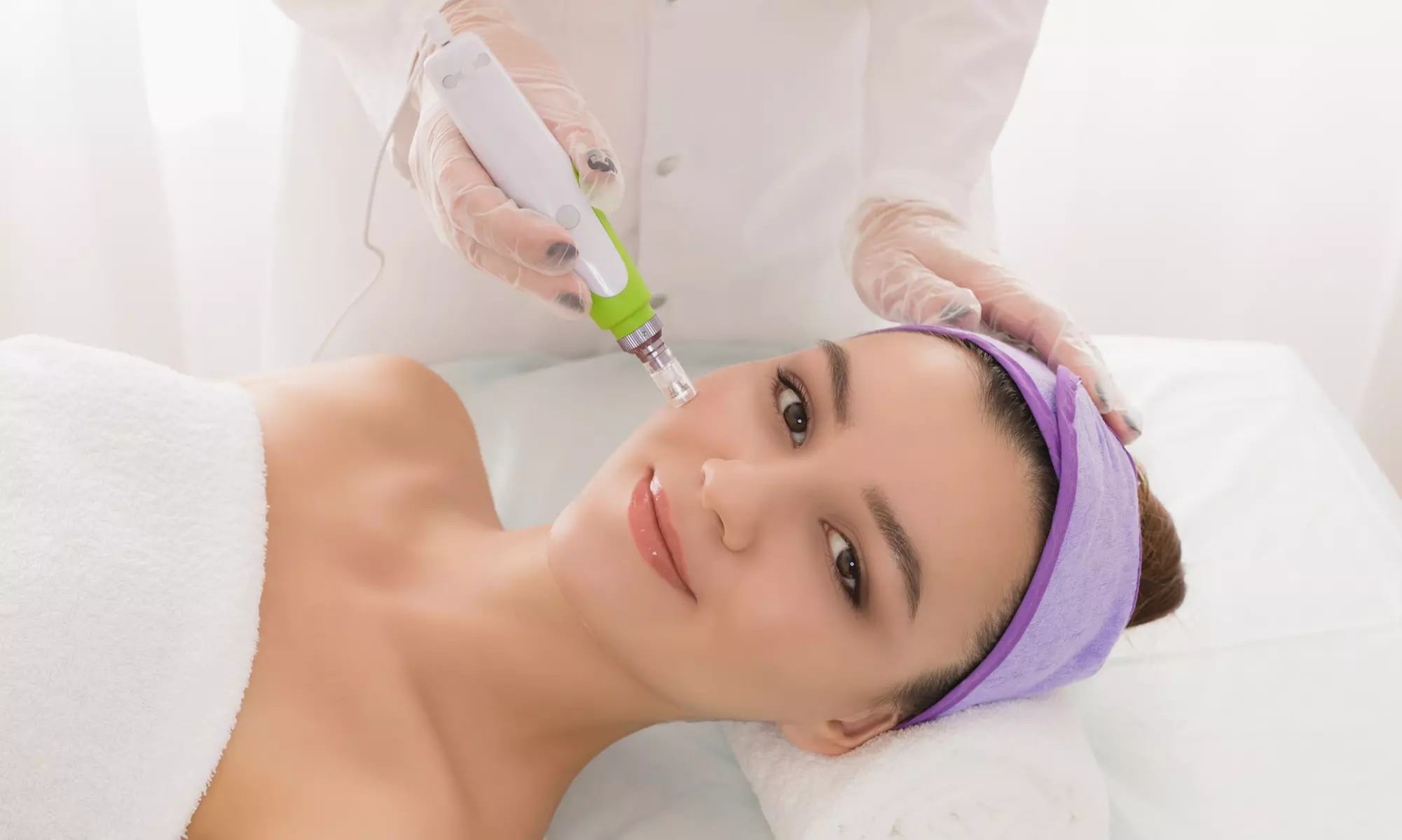 Fraktionierte Mesotherapie